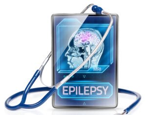 Epilepsy Monitoring Devices Market