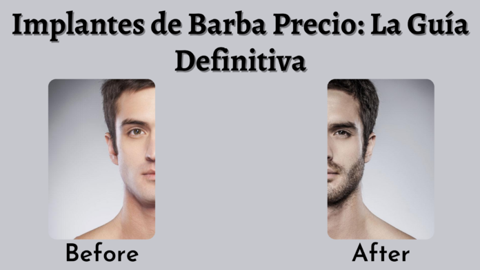 implante de barba precio